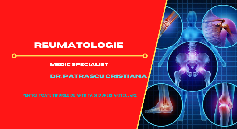 Consult reumatologic GRATUIT: gută, lupus sau artrita reumatoidă?