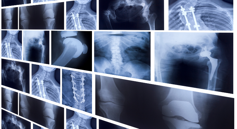 Imagistică medicală la Puls Medica – servicii, proceduri și avantaje